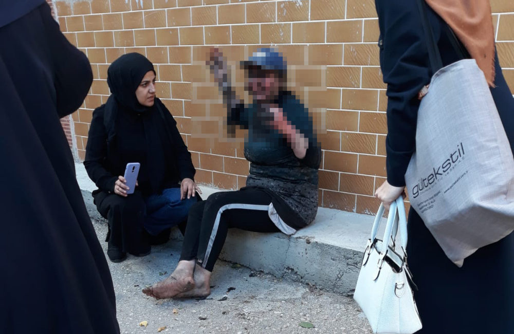 Bursa'nın Osmangazi ilçesinde, bir evde çıkan yangında vücudunda yanıklar oluşan