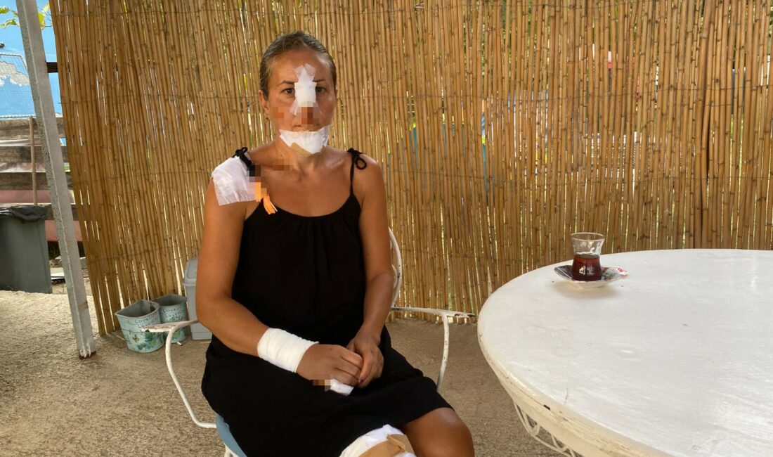 Bursa'dan tatil için gittikleri Erdek'te scooterla dolaşırken sahipsiz köpeklerin saldırısına