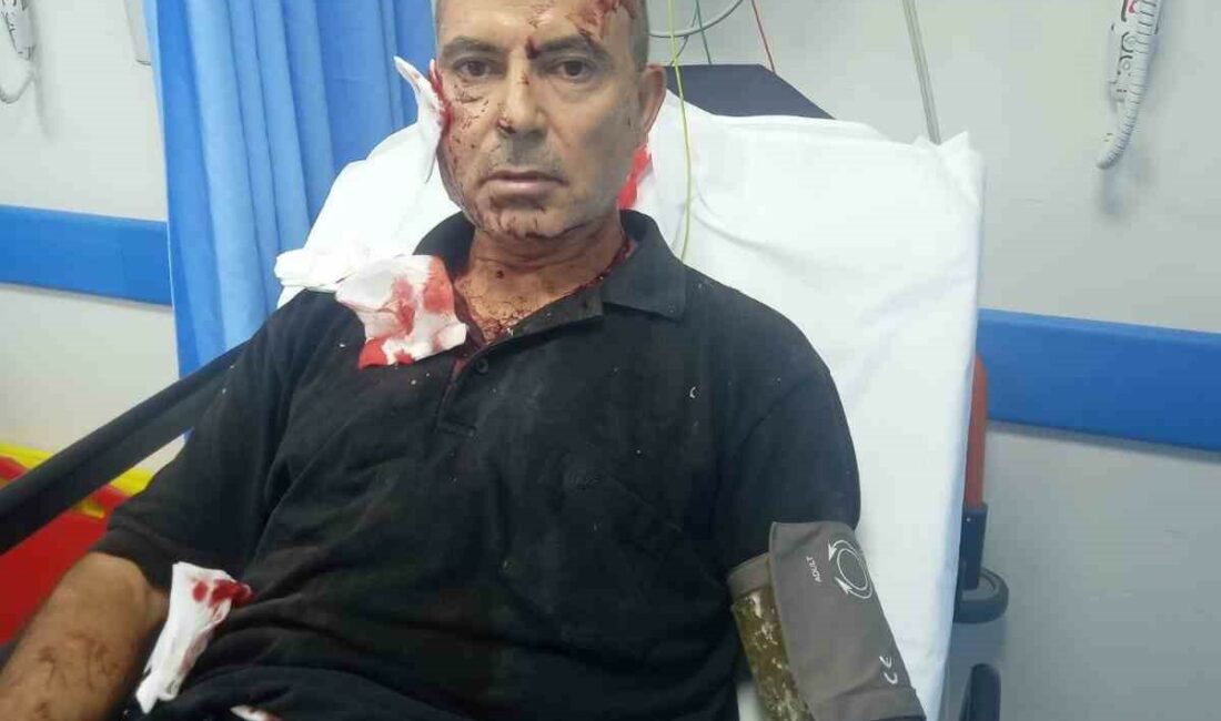 Bursa’da sahipsiz köpeklerin saldırısına uğrayan adam bu hale geldi BURSA’DA TARLASINI SULAMAYA GİDEN BİR ADAMA BAŞIBOŞ KÖPEK SALDIRDI. TALİHSİZ