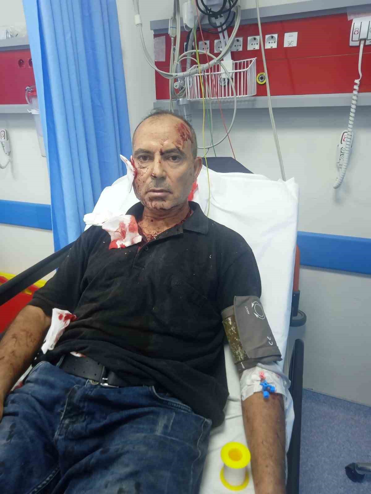 BURSA’DA TARLASINI SULAMAYA GİDEN BİR ADAMA BAŞIBOŞ KÖPEK SALDIRDI. TALİHSİZ