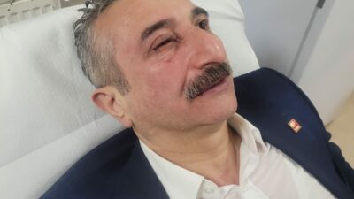 Bursa'da gösteriler sırasında CHP İl Başkanı Nihat Yeşiltaş yaralandı.