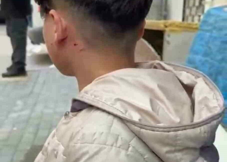 Camı tıklattığı için çocuğu darp etti Bursa’da dışarda oyun oynarken fazla ses çıkaran ve cama tıklayan