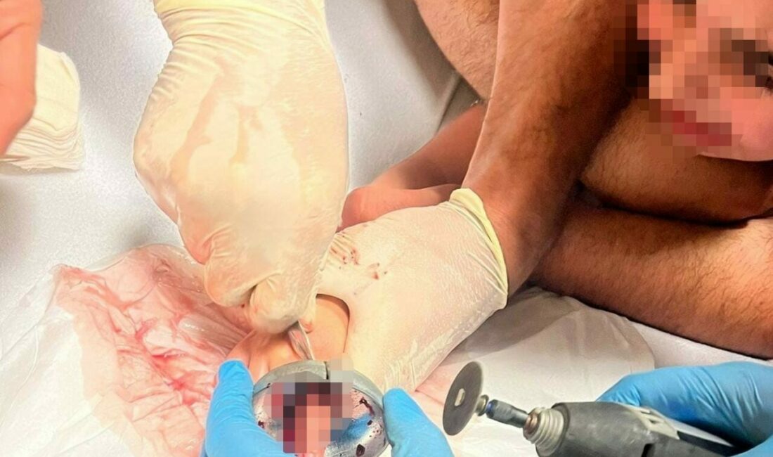 Bursa’nın İnegöl ilçesinde parmağı çeşme aynasına sıkışan çocuğu itfaiye ekipleri