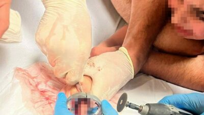 Bursa’nın İnegöl ilçesinde parmağı çeşme aynasına sıkışan çocuğu itfaiye ekipleri