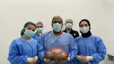 Bursa’da karın bölgesindeki şişlik nedeniyle hastaneye başvuran 40’lı yaşlardaki kadın