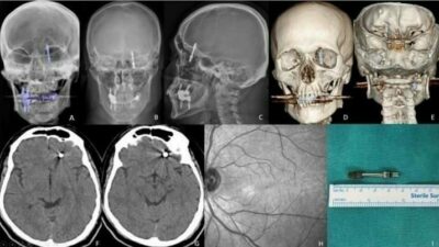 BURSA (İHA) – Bursa’da diş tedavisi için gittiği özel klinikte