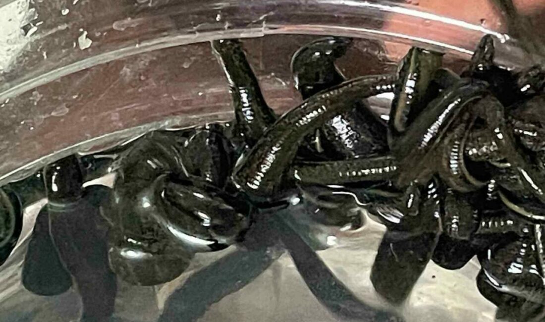 Son yıllarda birçok hastalığın tedavisinde şifasına başvurulan sülükler, kadınlar tarafından uzman