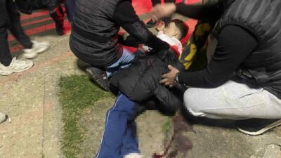 Bursa’nın Mudanya ilçesinde bir parkta çıkan bıçaklı kavgada 16 yaşındaki