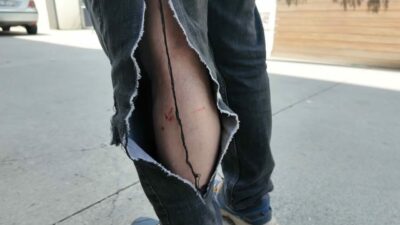Avcılar’da sabah saatlerinde yaya olarak işe giden vatandaş köpeklerin saldırısına