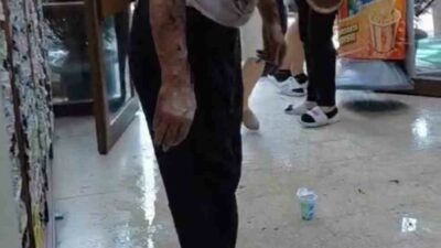 Bursa’da bir işhanında tıkanan lavabo giderini açmak için dökülen güçlü